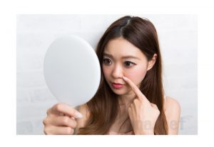肌 しわ ほうれい線