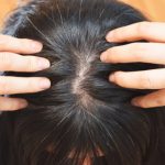 紫外線が髪や頭皮に与える危険な影響とは？毛髪へのダメージ対策のすすめ